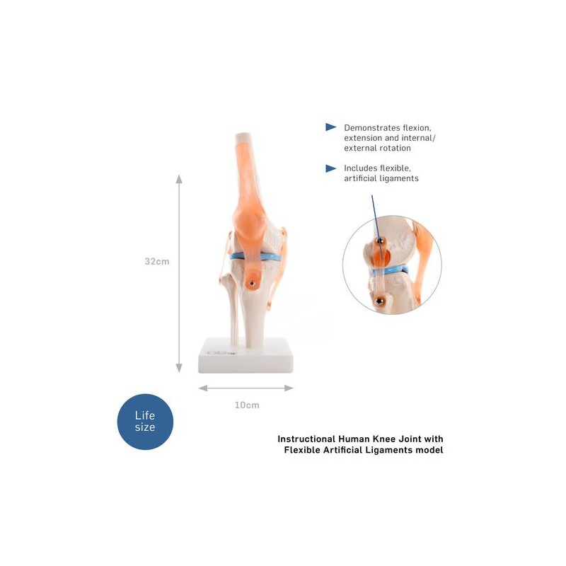 Anatómiai modell térd XC-111